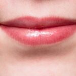 Ποιες επιλογές θεραπείας υπάρχουν για τις ρυτίδες του στόματος;